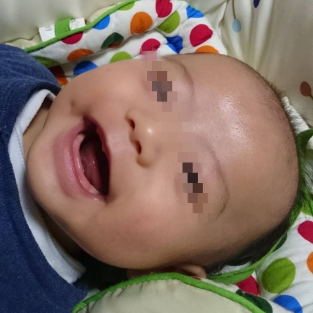 原因は 異常だと言われるほどひどかった乳児湿疹が１か月でつるつるに So Da To こどもと一緒にそだと 育児情報メディア